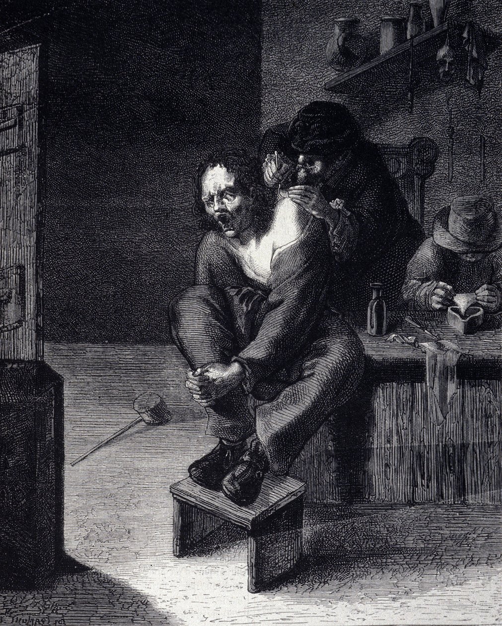 De chirurgische operatie Gravure naar een schilderij van Adrien Brauwer (overleden 1608) 17e eeuw door Adriaen (after) Brouwer