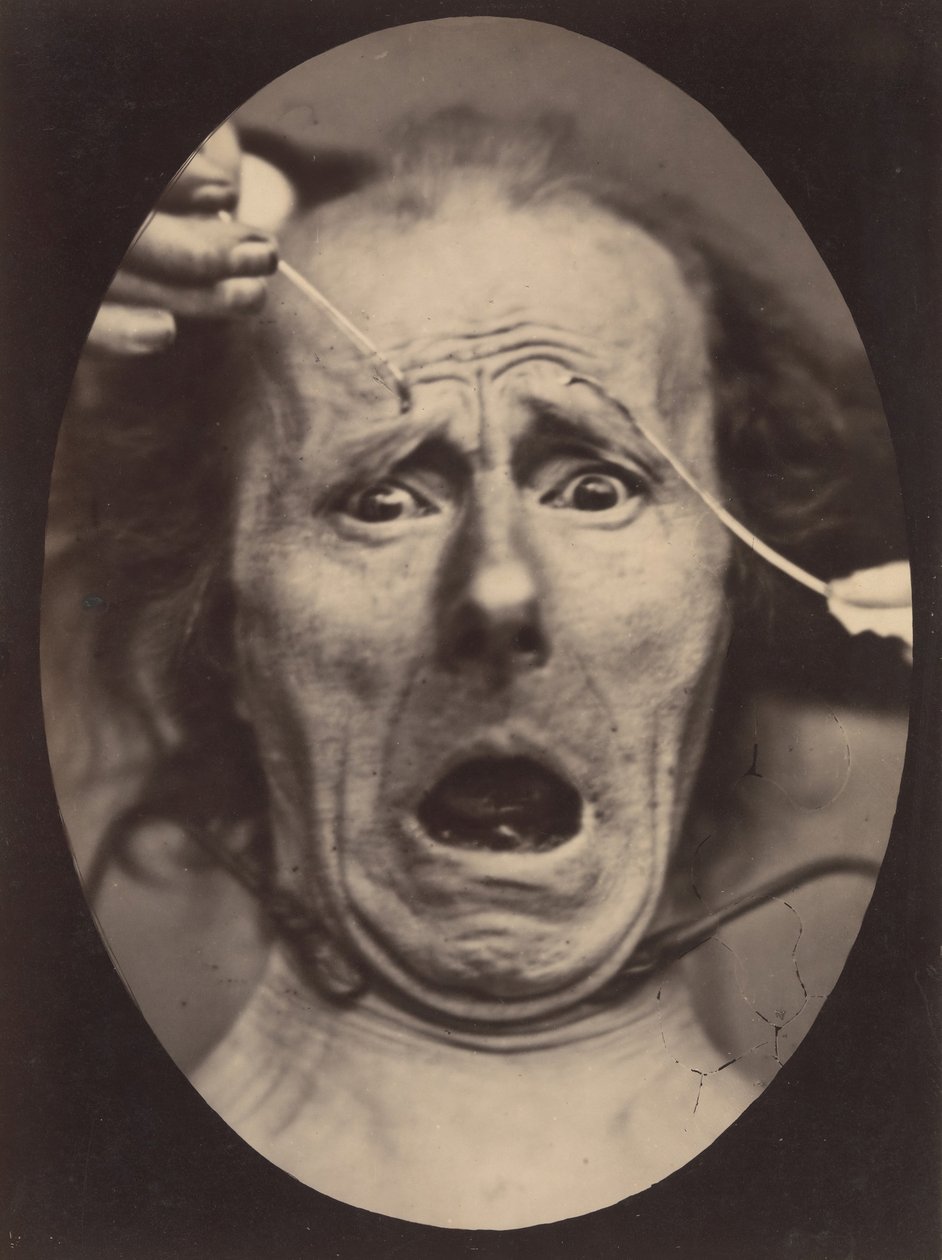 Electro-Physiologie, figuur 64, 1854-56, gedrukt 1862 door Adrien Alban Tournachon