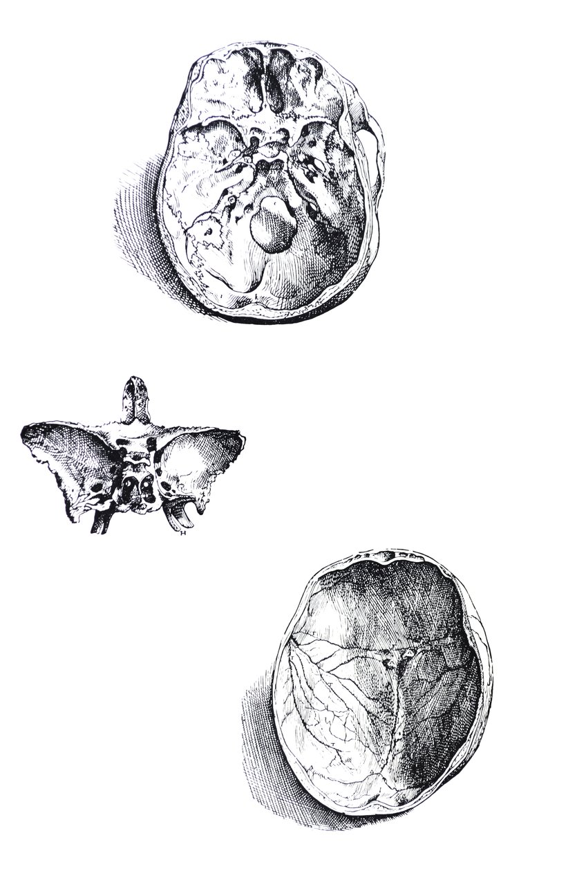De platen uit het eerste boek van de De Humani Corporis Fabrica door Andreas Vesalius