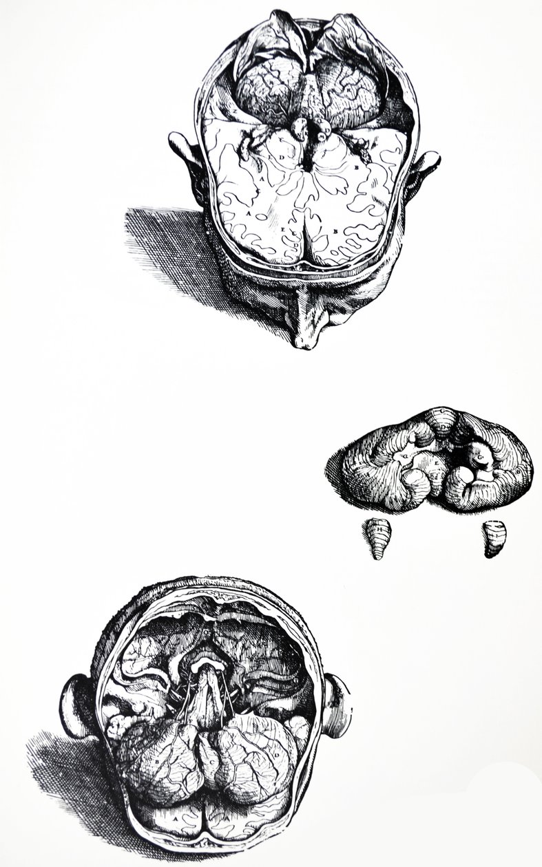 De Platen uit het Zevende Boek van de De Humani Corporis Fabrica door Andreas Vesalius