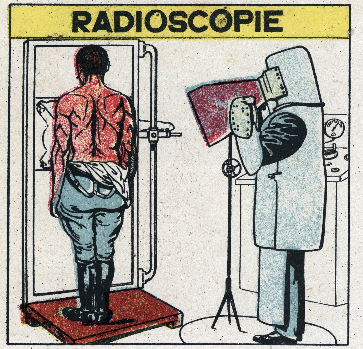 Röntgenstralen: radioscopie van een menselijk lichaam. De radioloog beschermt zich tegen röntgenstralen door een rubberen doek te dragen met een rubberoplossing die loodzouten bevat, zijn hoofd is bedekt met een muts en zijn handen met handschoenen van het door Anonymous Anonymous