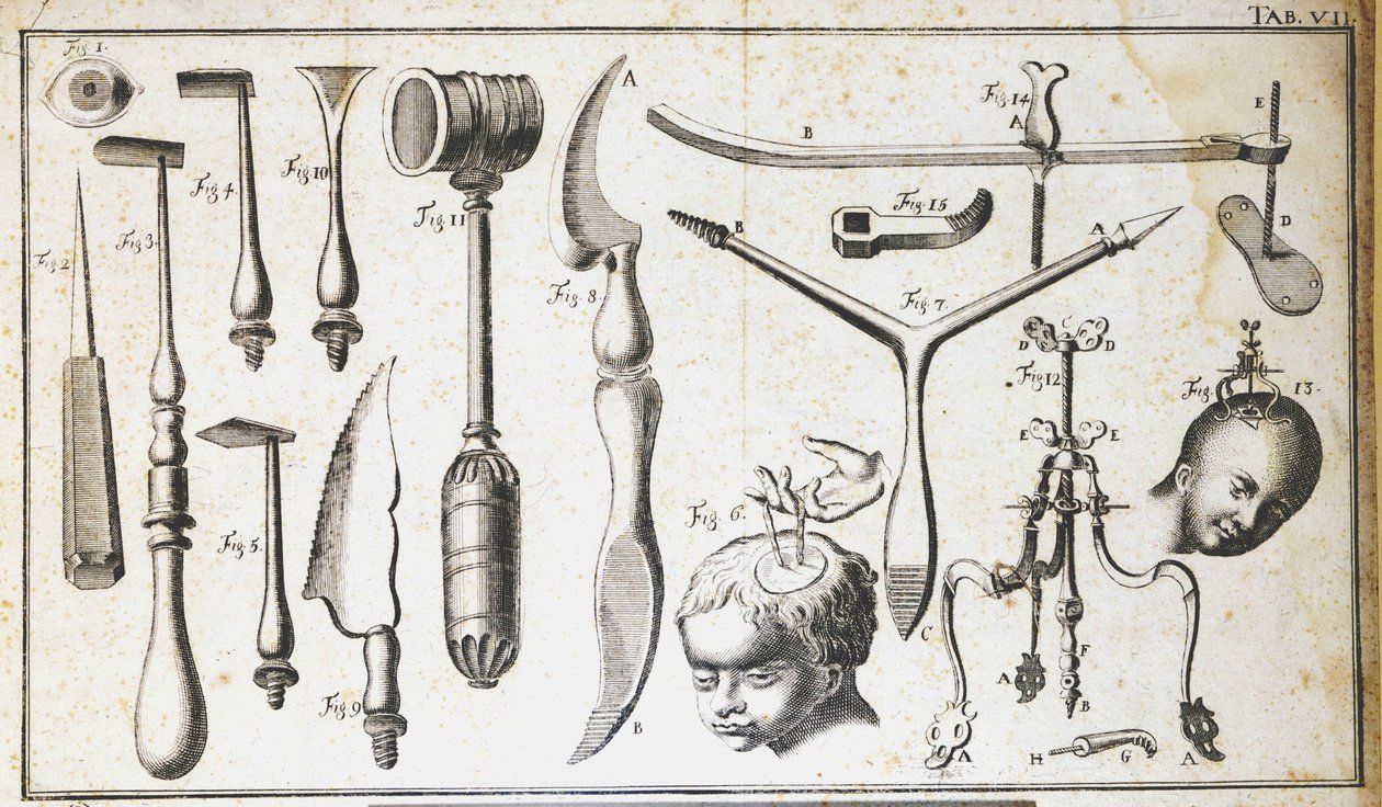 Chirurgische plaat met verschillende soorten chirurgische instrumenten, hamer, schelp, messen, voor het verwijderen van de hersenen. Gravure door Benoit Louis Prevost (1735-1809) 18e eeuw door Benoit Louis Prevost