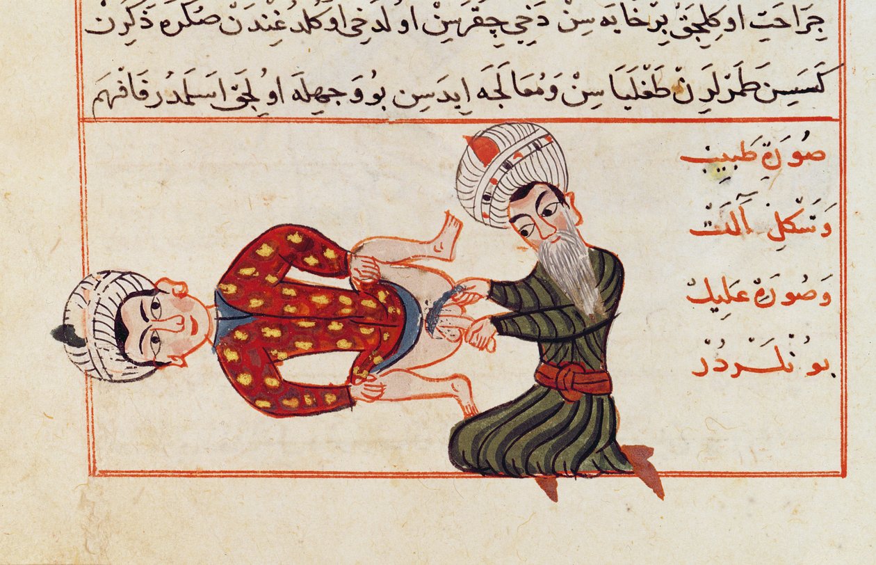 Ms Sup Turc 693 fol.76v Operatie voor castratie, 1466 door Charaf-ed-Din