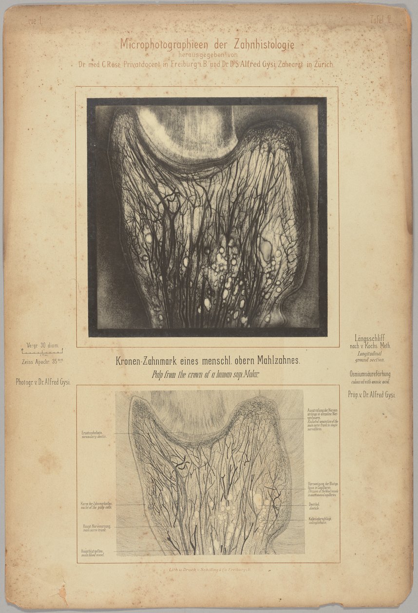 Pulp van de kroon van een menselijke sup. molaar door Dr. Alfred Gysi