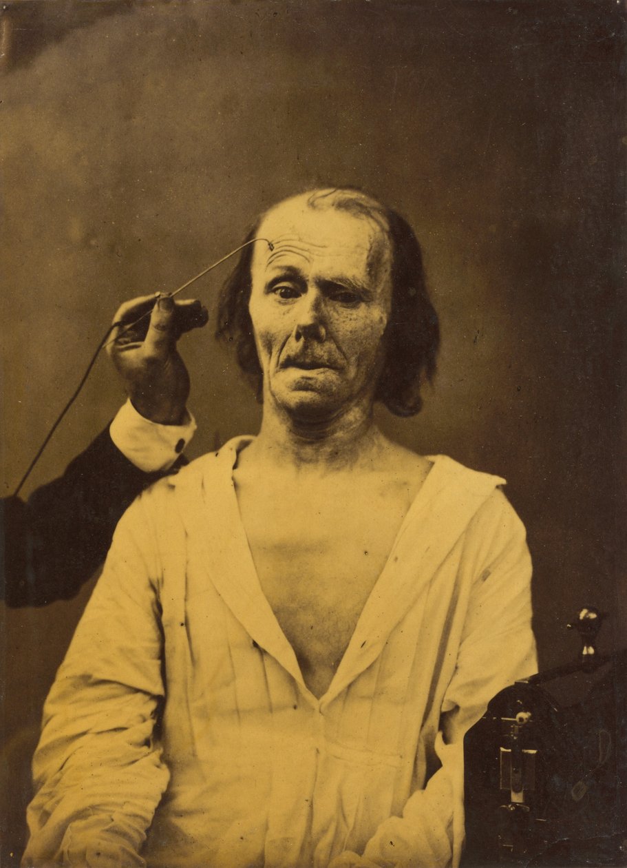 Een ontspannen gezicht links, Diepe aandacht rechts, 1854-1856, gedrukt 1862 door Duchenne de Boulogne