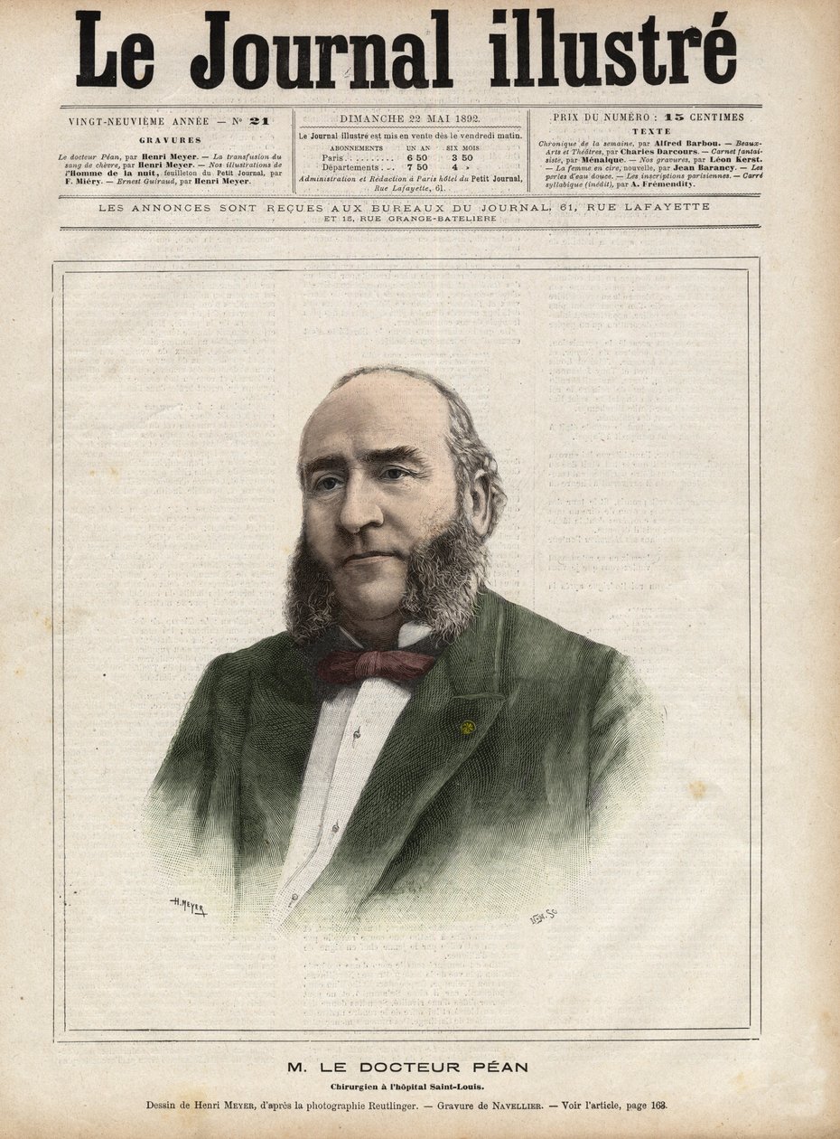 Portret van Jules Emile Pean (1830-1898), Franse chirurg - Gravure door Navellier in 