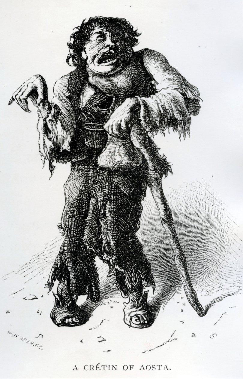 Een cretin van Aosta, ca. 1870 door Edward Whymper