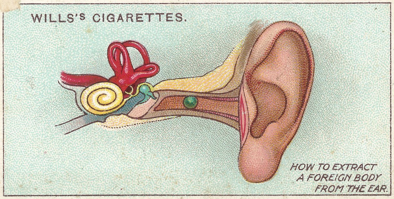 Vreemd lichaam in oor, nr. 30 uit de Eerste Hulp-serie van Willss cigarettes kaarten door English School