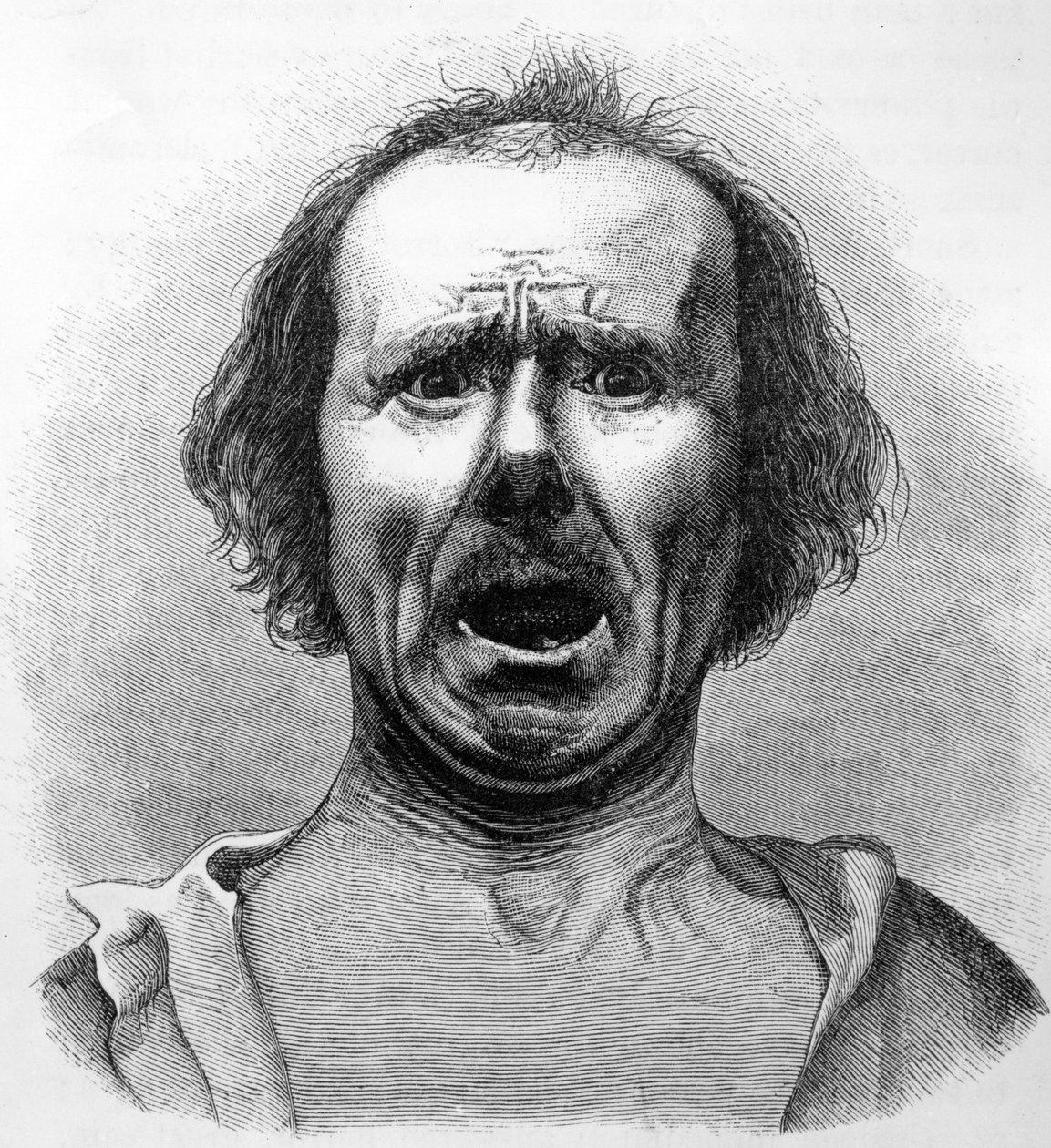 Horror en Agonie, gekopieerd van een foto door Dr. Duchenne, illustratie uit 