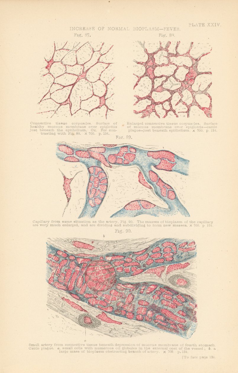 Toename van normaal bioplasma, koorts (kleurenlitho) door English School