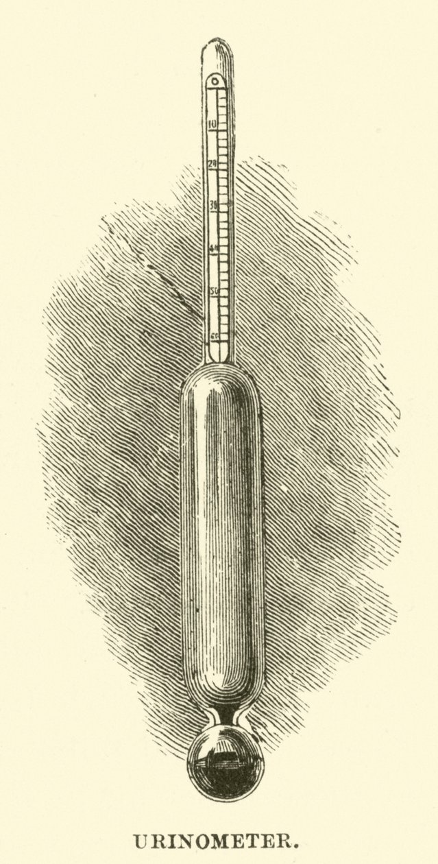 Urinometer (gravure) door English School