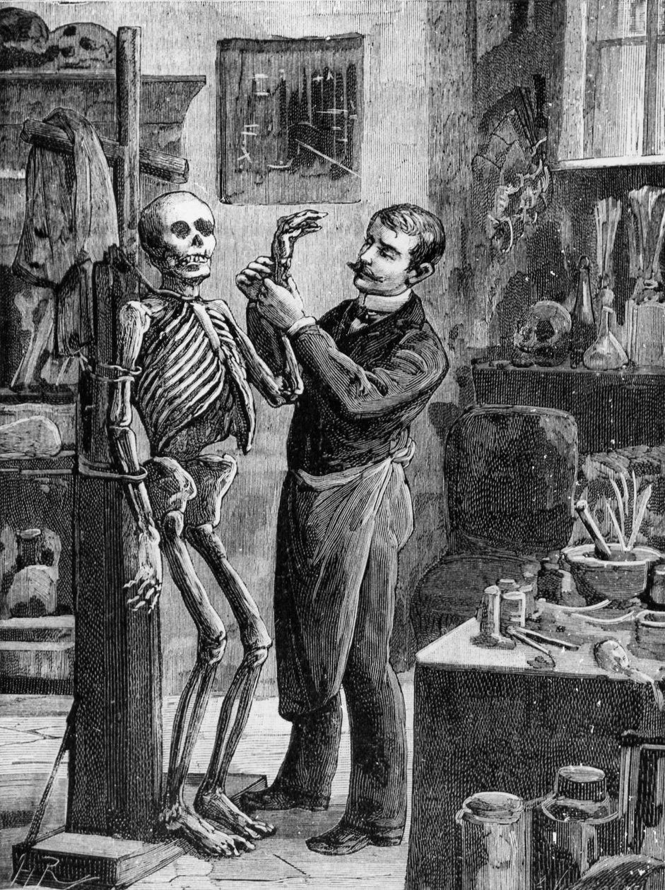 Zaak Gouffé: De imaginaire reconstructie van het lijk Gouffé door dr. Lacassagne - in 