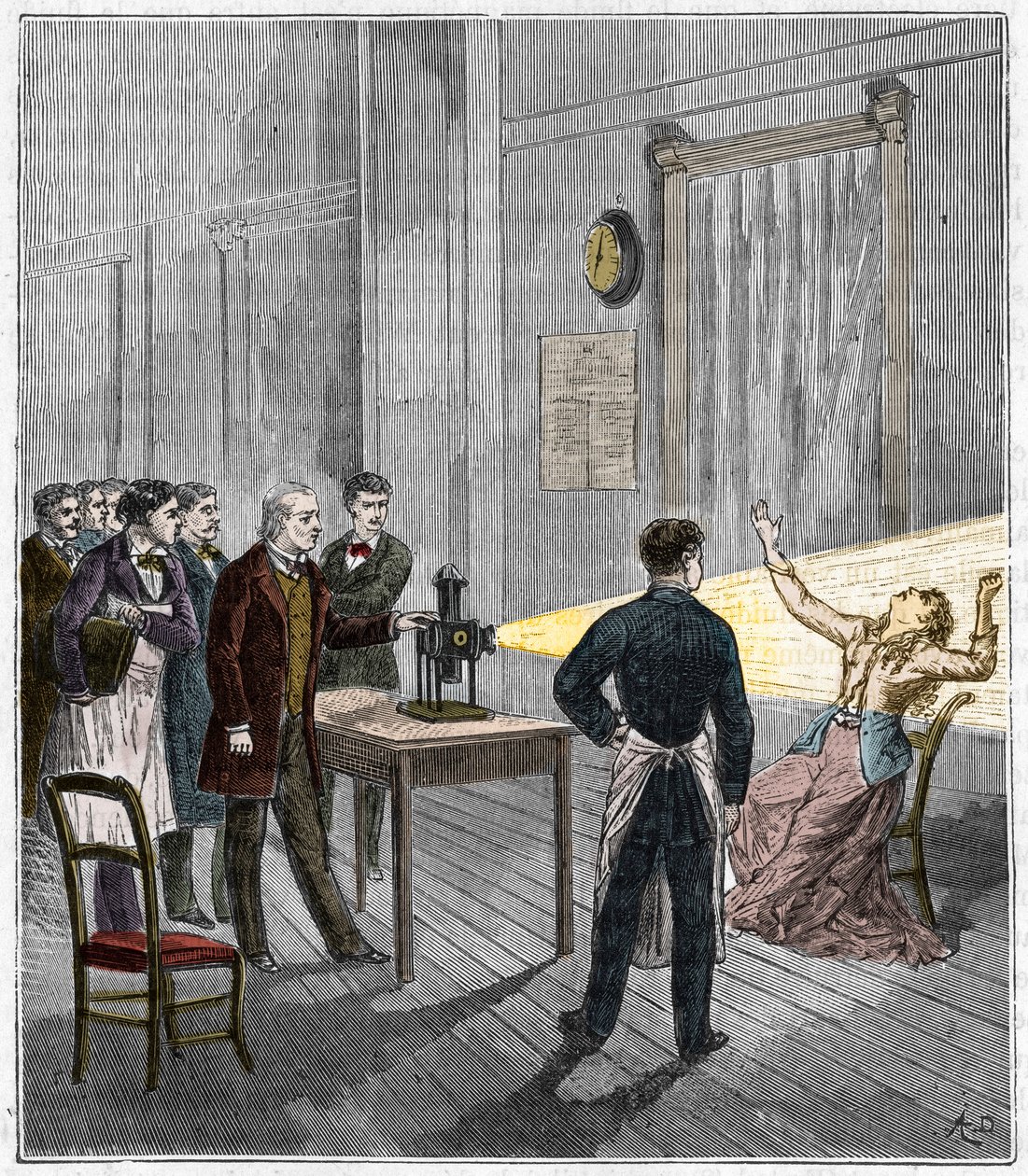 Katalepsie veroorzaakt onder invloed van licht - De Franse neuroloog Jean Martin Charcot (1825-1893) bestudeert het fenomeen van hypnose bij een patiënt in het Salpetriere-ziekenhuis met behulp van een toverlantaarn - Katalepsie - Jean Martin Charcot (1825 door French School