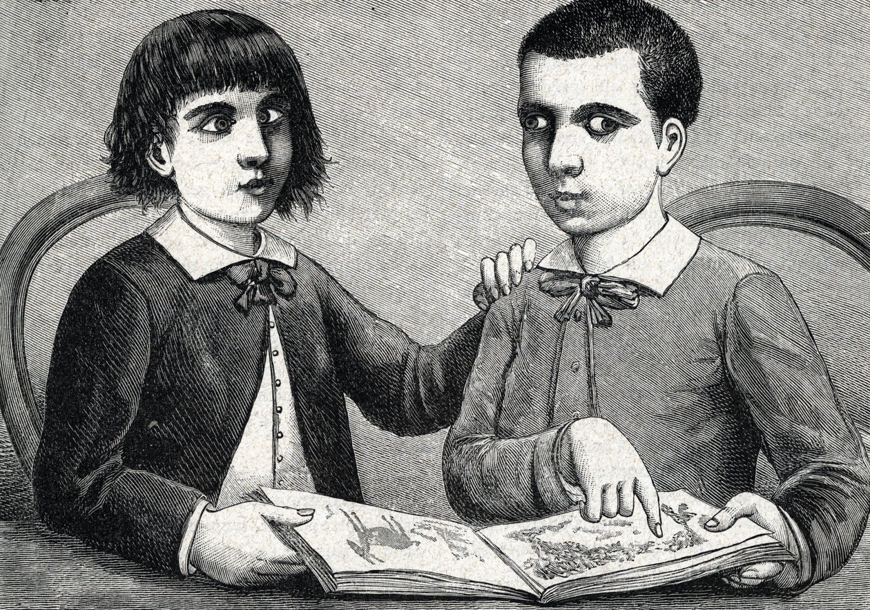 Kinderen met convergerende en divergerende strabismus of scheelzien (gravure) 1888 door French School