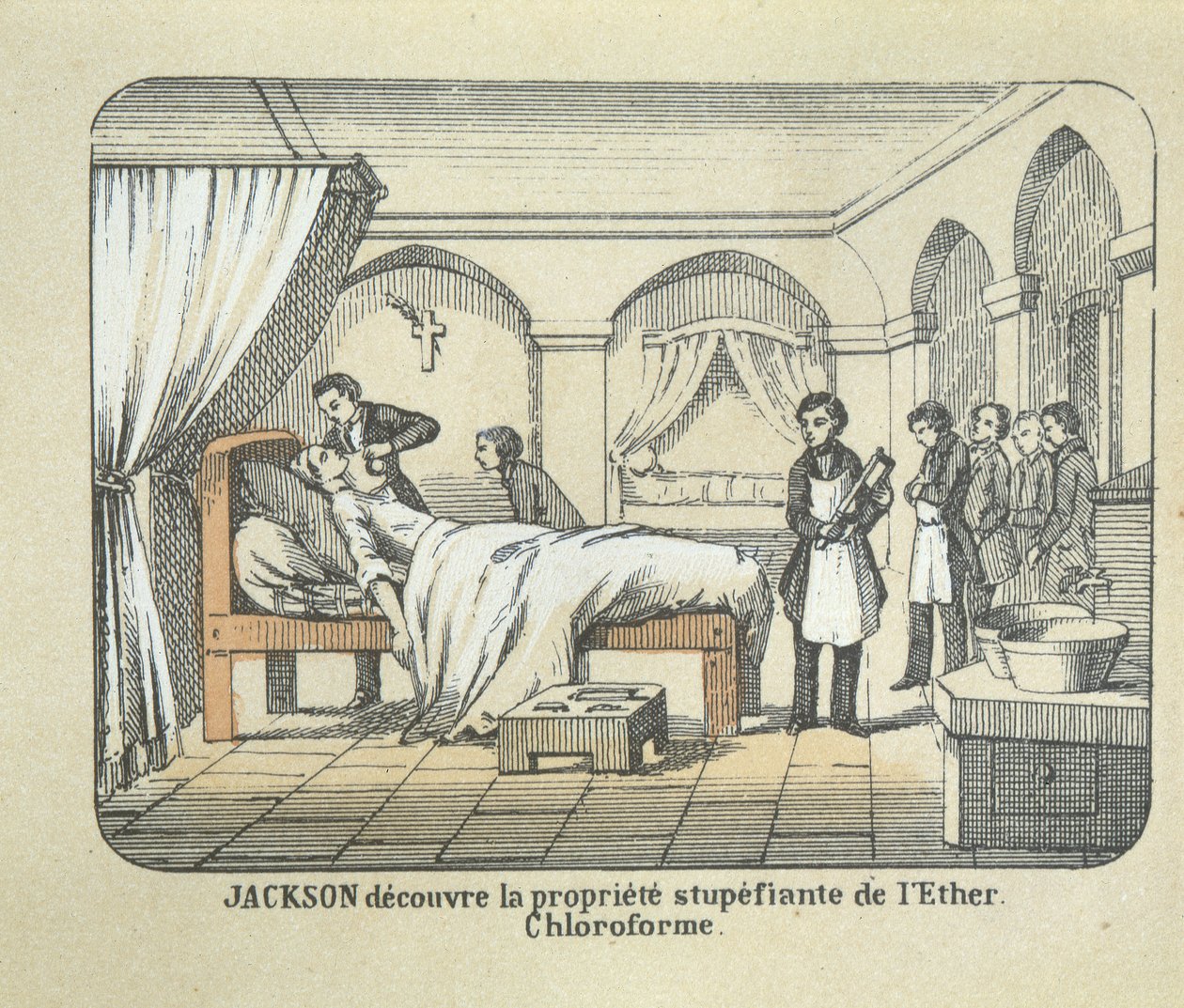 Dr. Charles Jackson (1805-80) ontdekt de verdovende eigenschappen van ether door French School