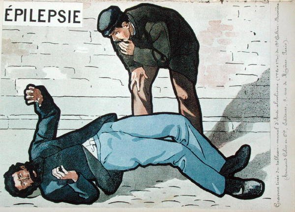 Epileptische aanval veroorzaakt door acute alcoholisme, uit Dr Galtier-Boissiere