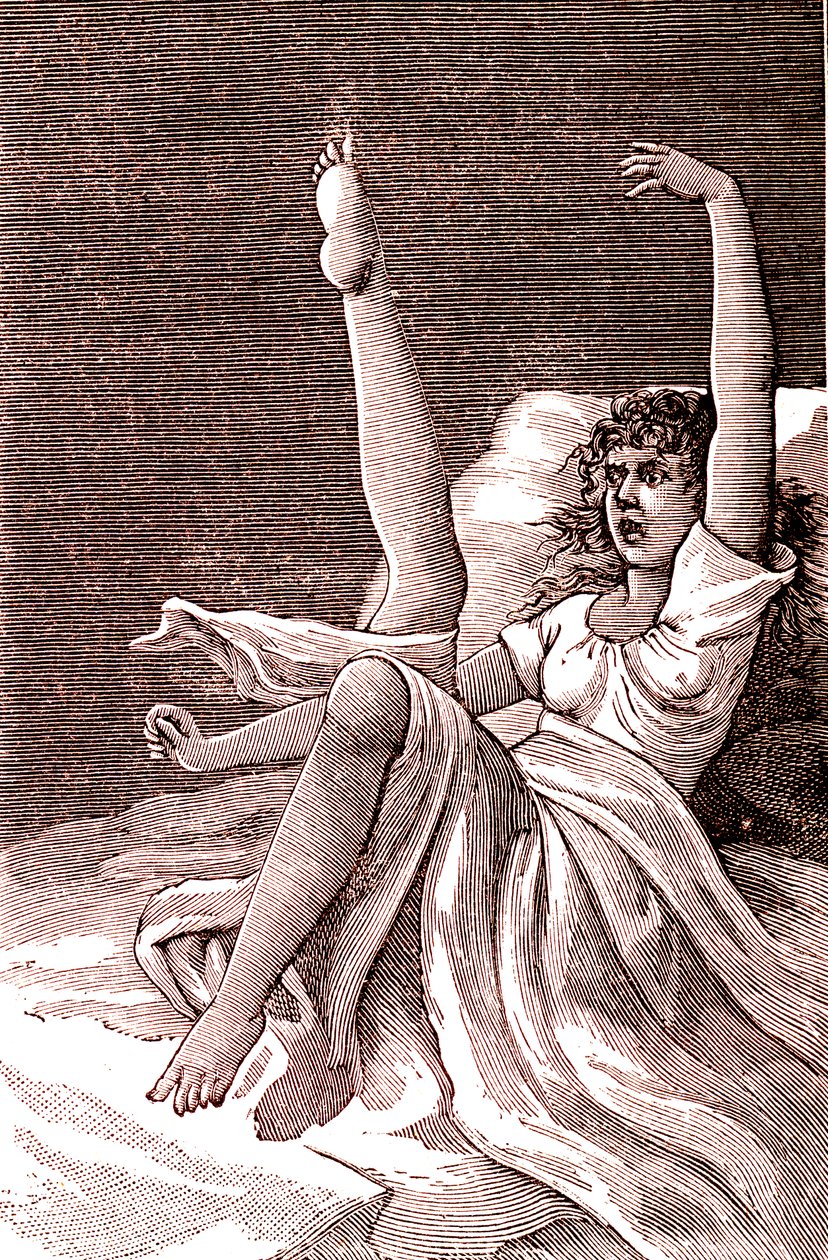 Hysterie, een extreem mentaal fenomeen, psychosen en psychoneurosen.1887 door French School