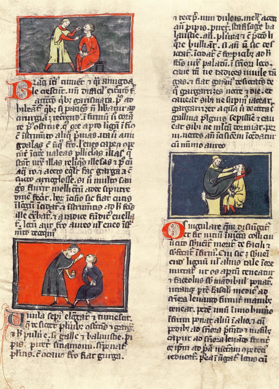 Ms H 89 fol.16v Tandheelkundige chirurgie, uit een editie van het 