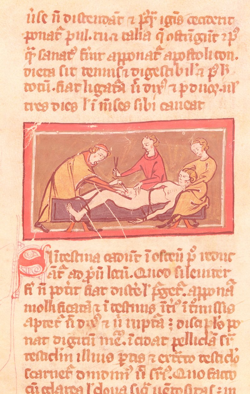 Chirurgie, uit een editie van het Boek van Chirurgie door Rogier de Salerne door French School