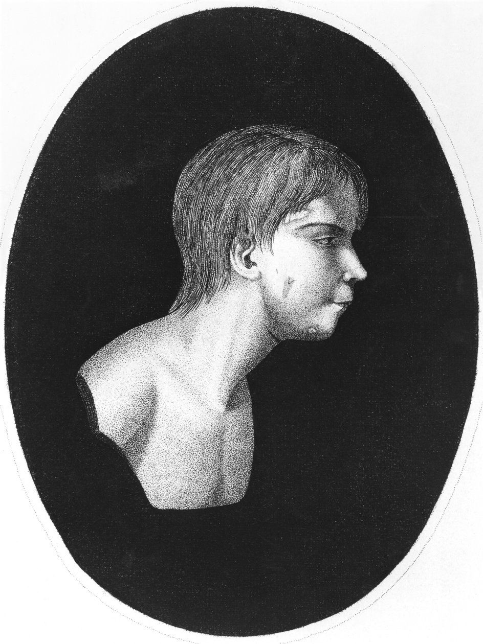Victor van Aveyron, frontispice van De l