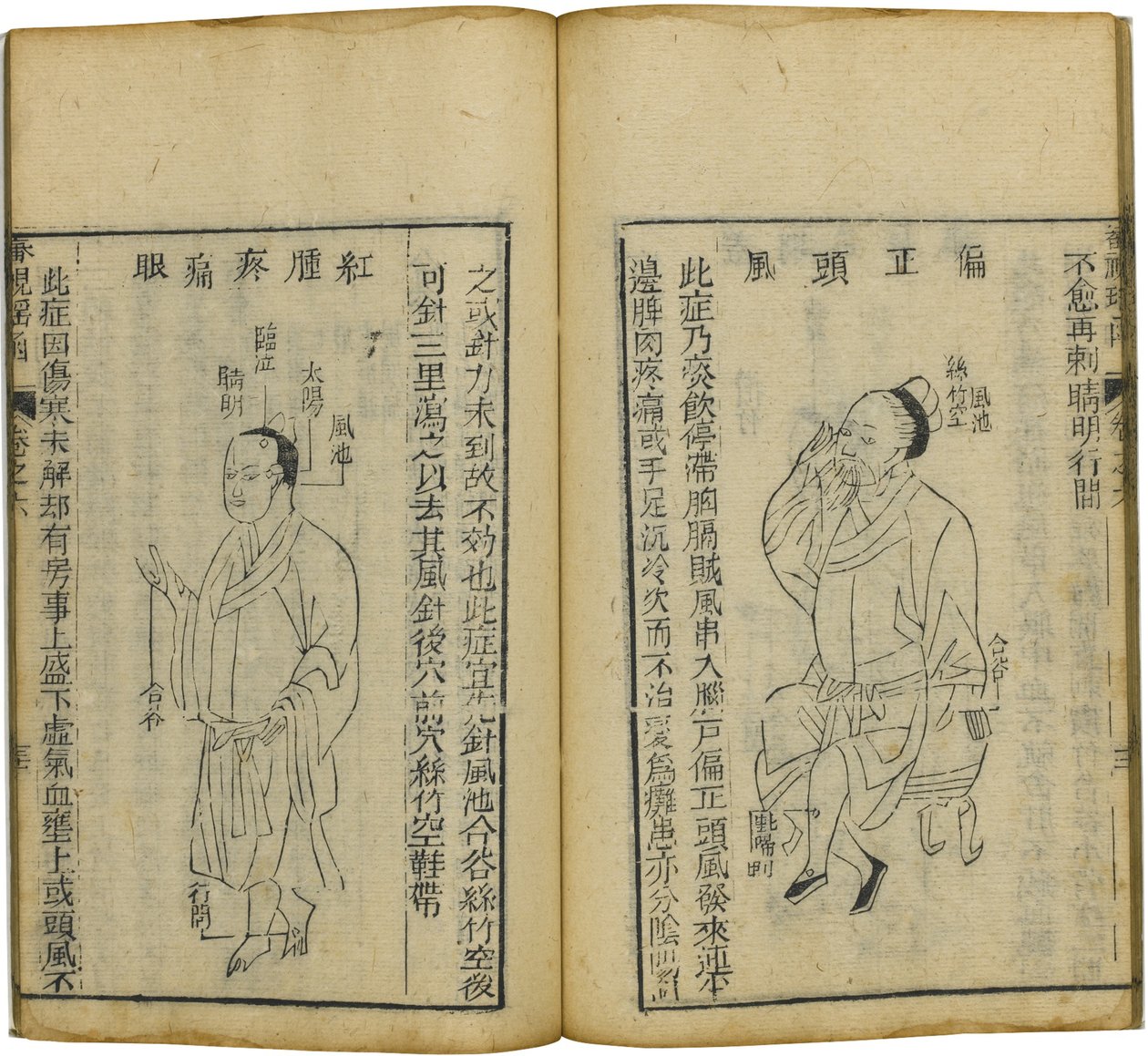 Shen Shi Yao Han Een Kostbaar Boek over Oogheelkunde, 1644 door Fu Renyu