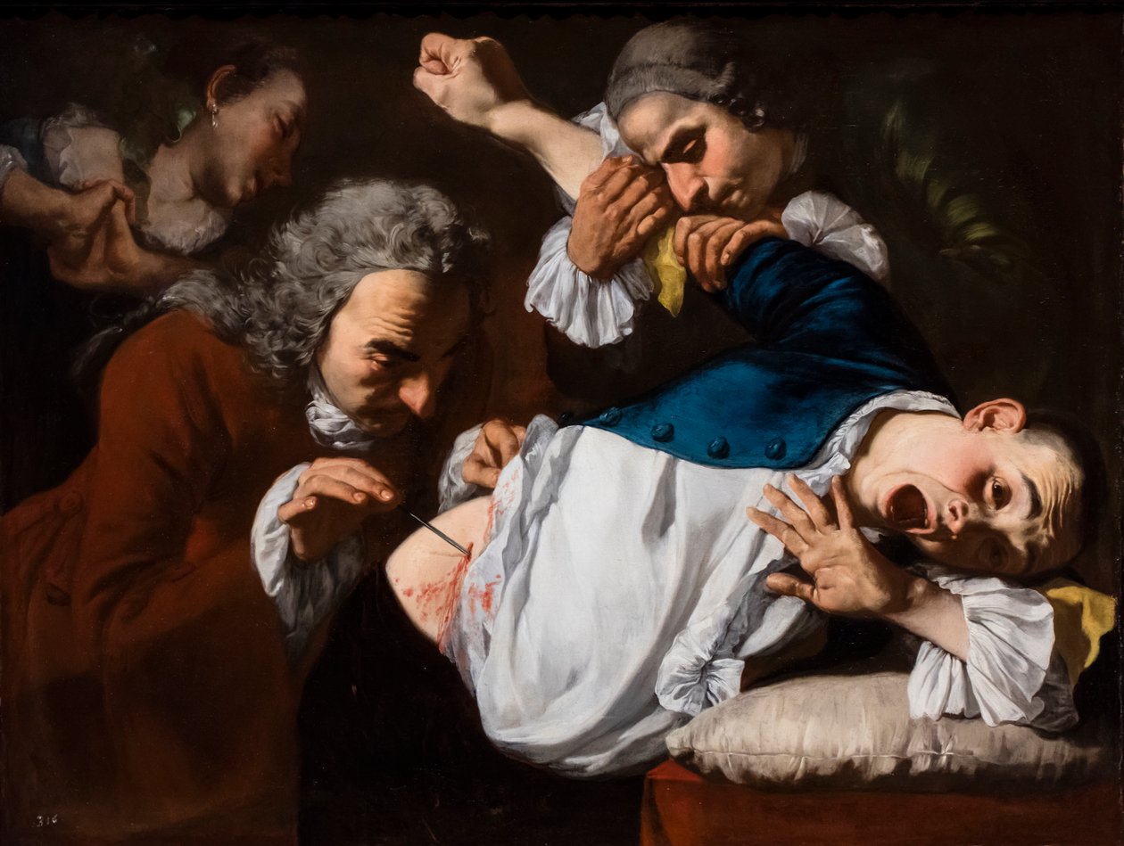 De operatie, circa 1753/54 (Olieverf op doek) door Gaspare Traversi