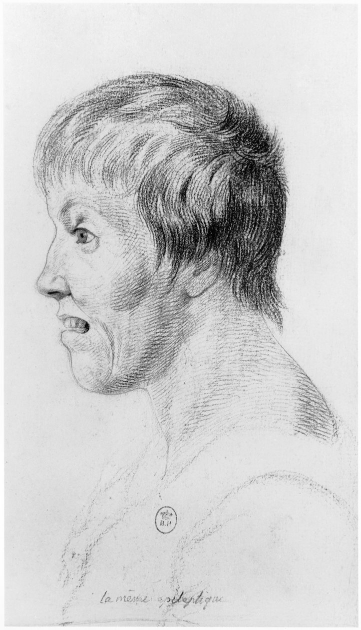 Epileptische vrouw, profiel, illustratie uit een onuitgegeven verhandeling door Jean Etienne Dominique Esquirol (1772-1840) over de krankzinnigen van het Salpetriere asiel, c.1818 door Georges Francois Gabriel