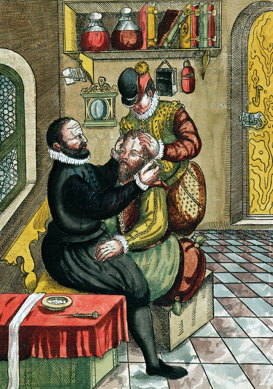 Staaroperatie, uit Ophthalmodouleia door Georg Bartisch (1535-1636) gepubliceerd in Dresden in 1583 door German School