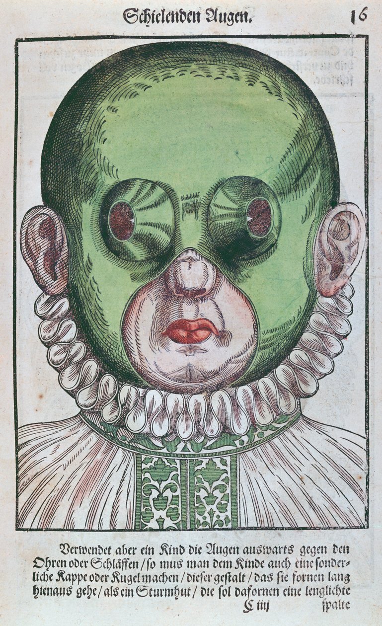 Masker voor de behandeling van strabismus, uit Ophthalmodouleia door Georg Bartisch, gepubliceerd in Dresden in 1583 door German School