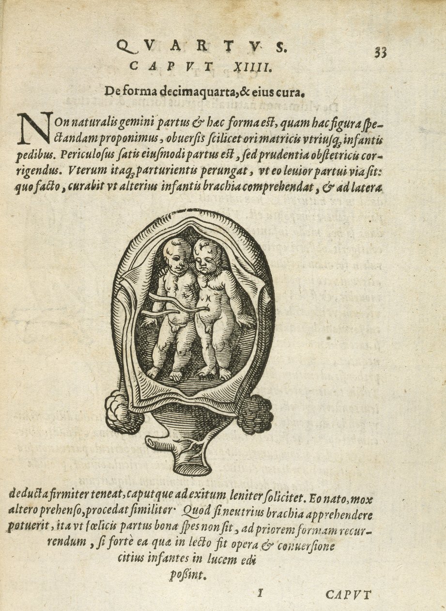 Niet-identieke tweelingen in de baarmoeder, illustratie uit hoofdstuk 14, Boek 4 van Over de conceptie en groei van de mens door Rueff, 1587 door German School