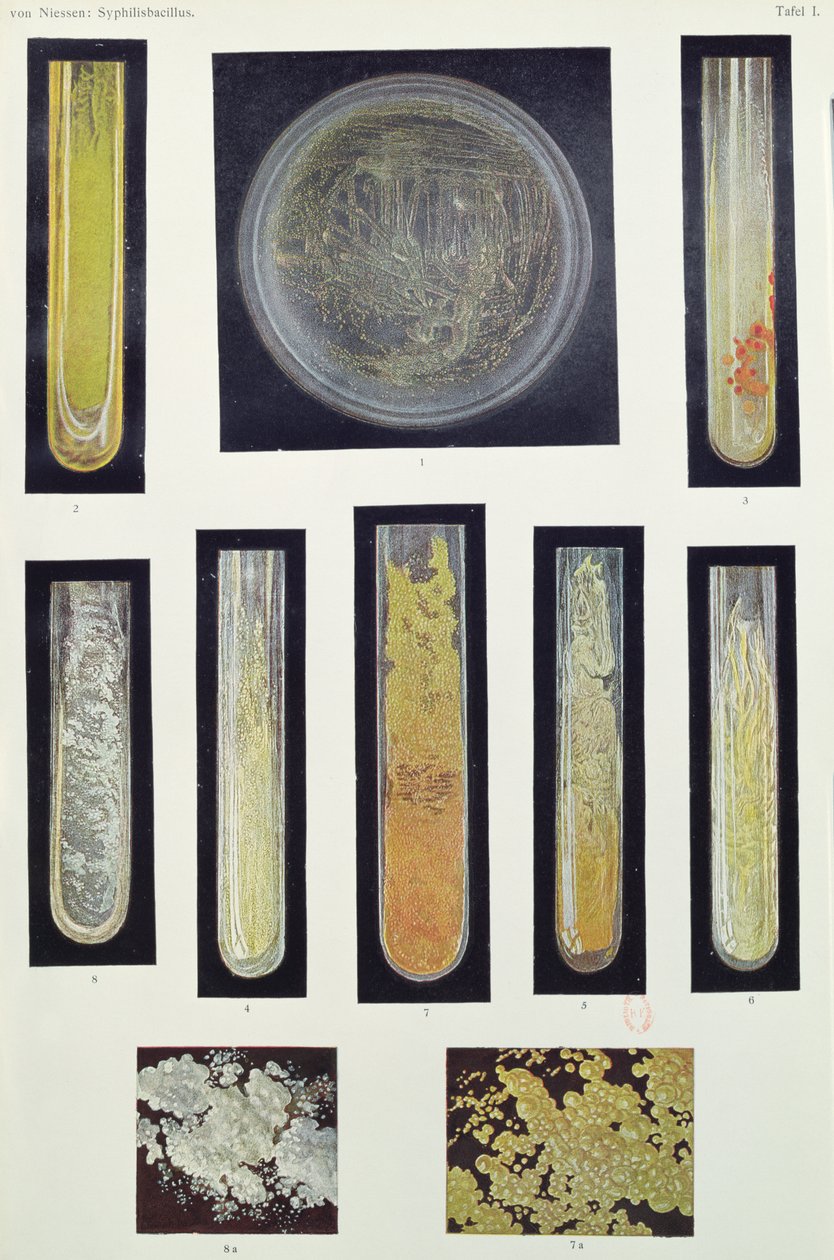 Syfilis Bacillus, uit een boek door Max von Niessen, Leipzig, 1908 door German School