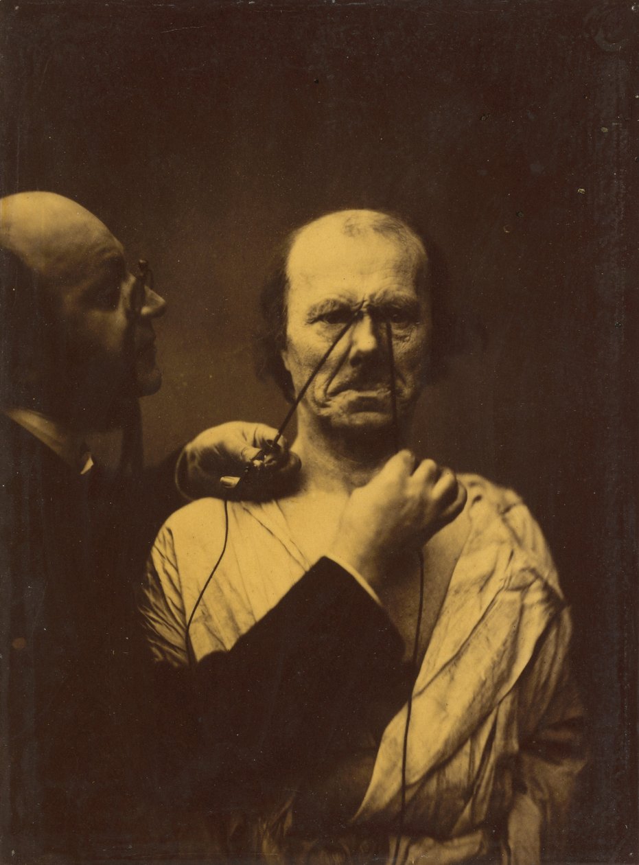 Agressie, boosaardigheid,1854-1856, gedrukt 1862 (foto) door Guillaume-Benjamin-Armand Duchenne de Boulogne