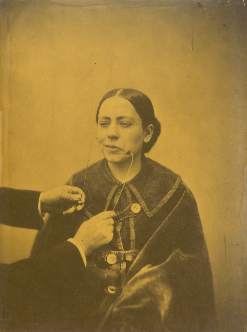 Verachtelijke afkeer (links); Verachtelijk lachen (rechts),1854-1856, gedrukt 1862 (foto) door Guillaume Benjamin Armand Duchenne de Boulogne