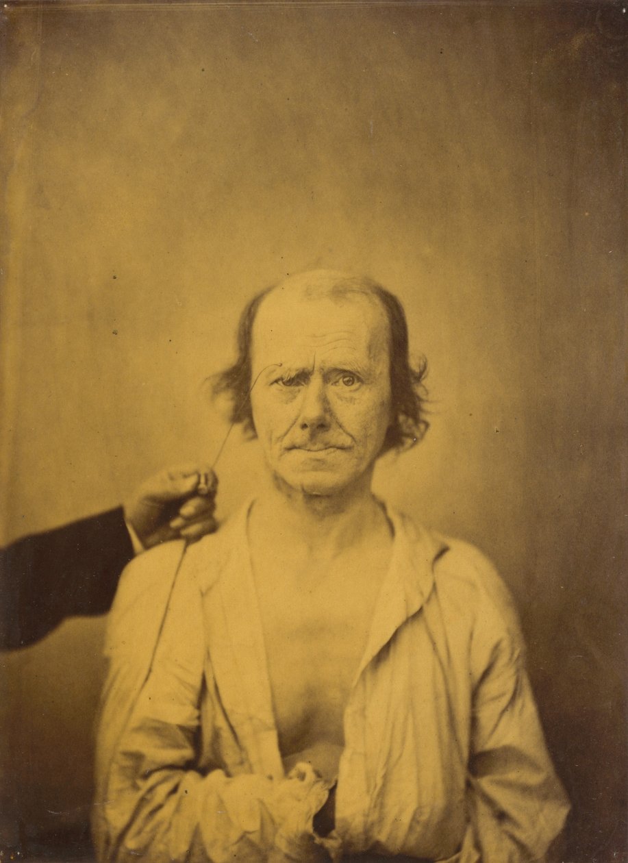 Aandacht (links); Reflectie (rechts) door Guillaume Benjamin Amant Duchenne