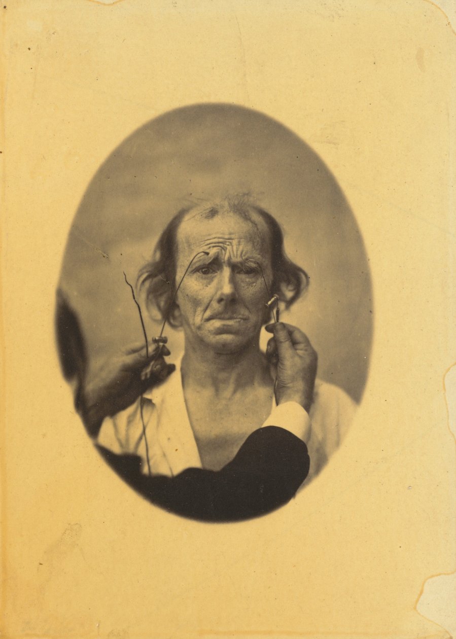 Ontevredenheid, sombere gedachten (links); Reflectie (rechts) door Guillaume Benjamin Amant Duchenne