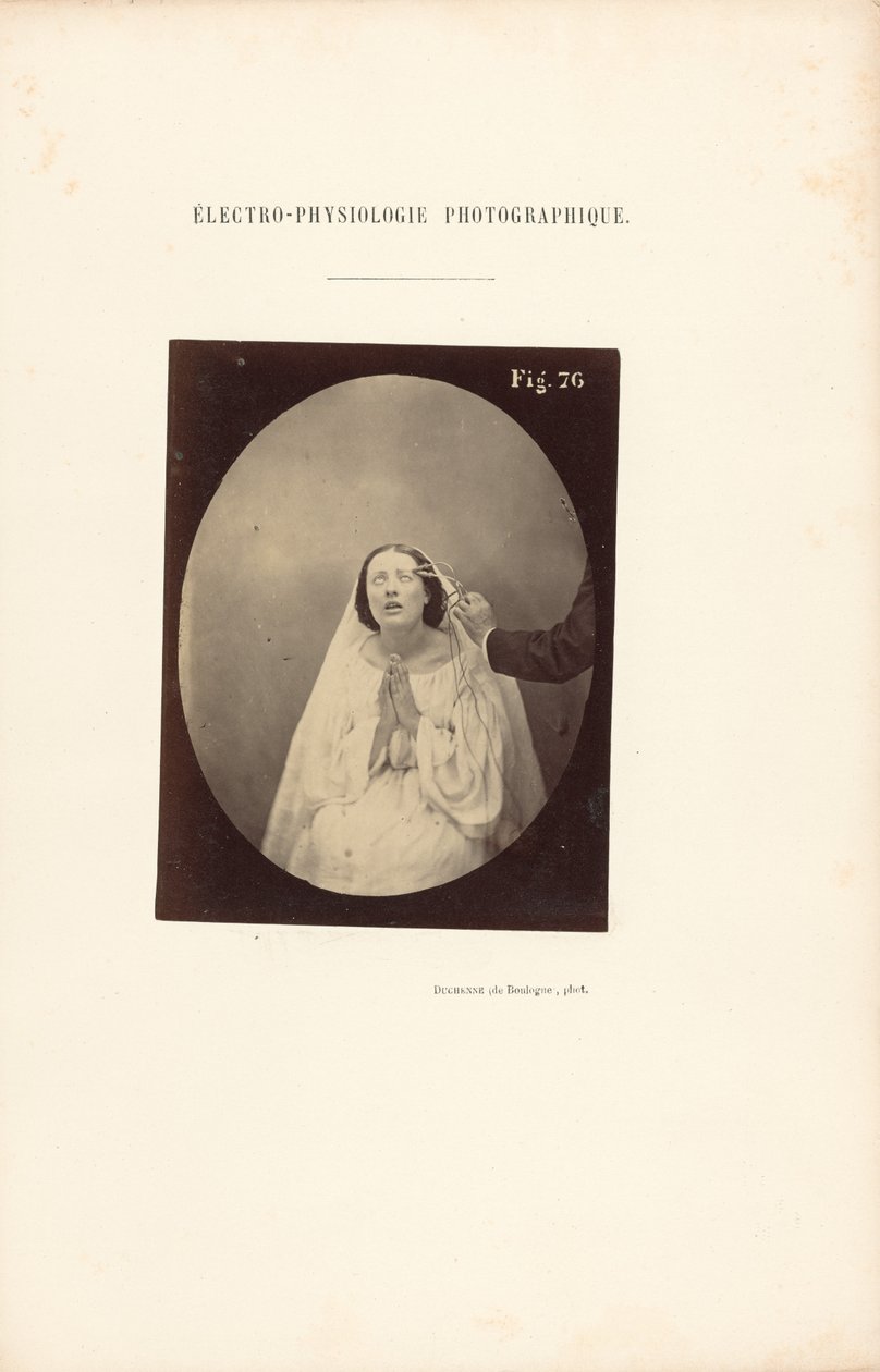 Fotografische elektrofysiologie, Afbeelding 76 door Guillaume Benjamin Duchenne