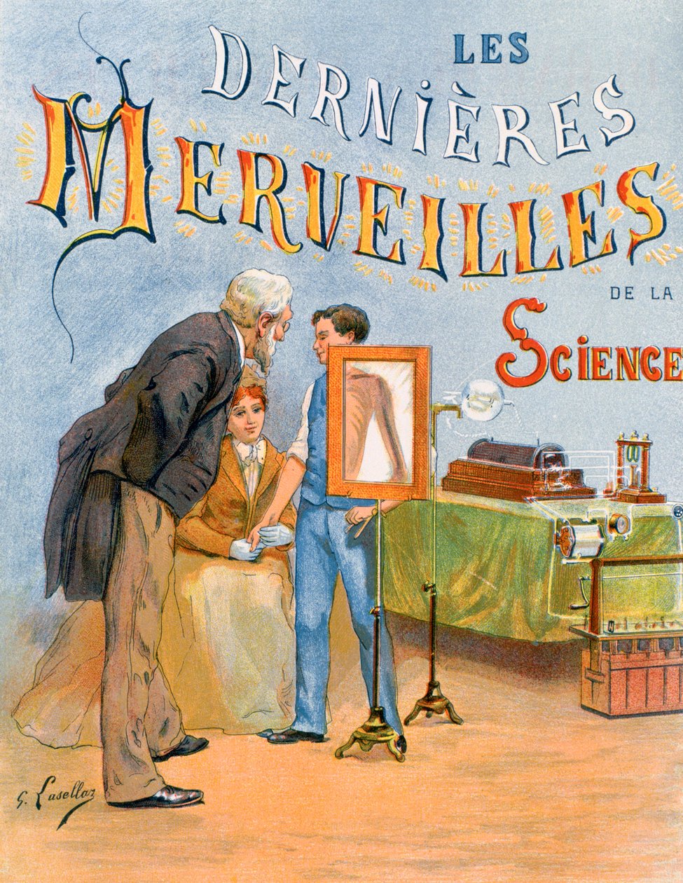 Het onderzoek van een kinderarm door radiografie door Gustave Francois Lasellaz