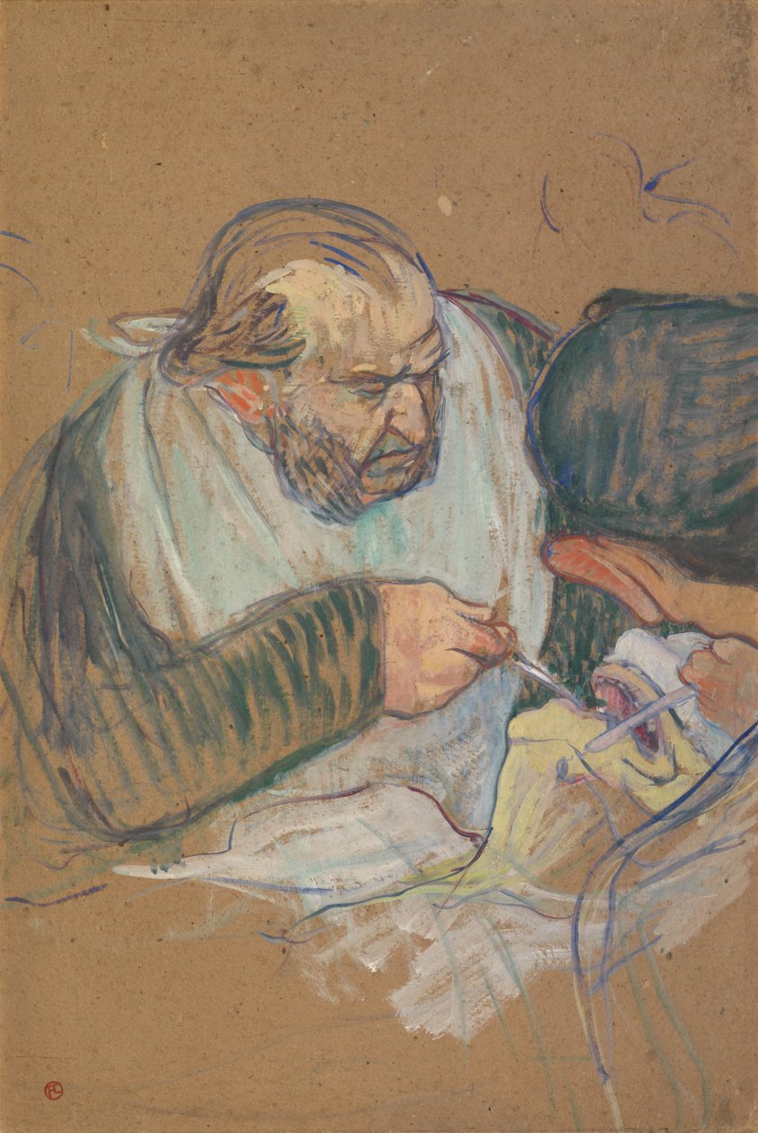 Dr. Péan opereert door Henri de Toulouse-Lautrec