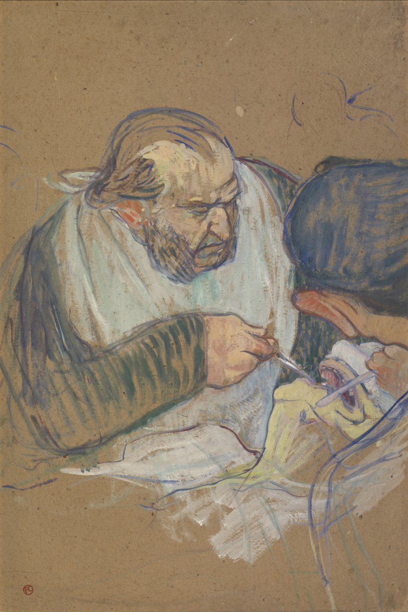 Dr. Péan Opererend, 1891-92 door Henri de Toulouse Lautrec