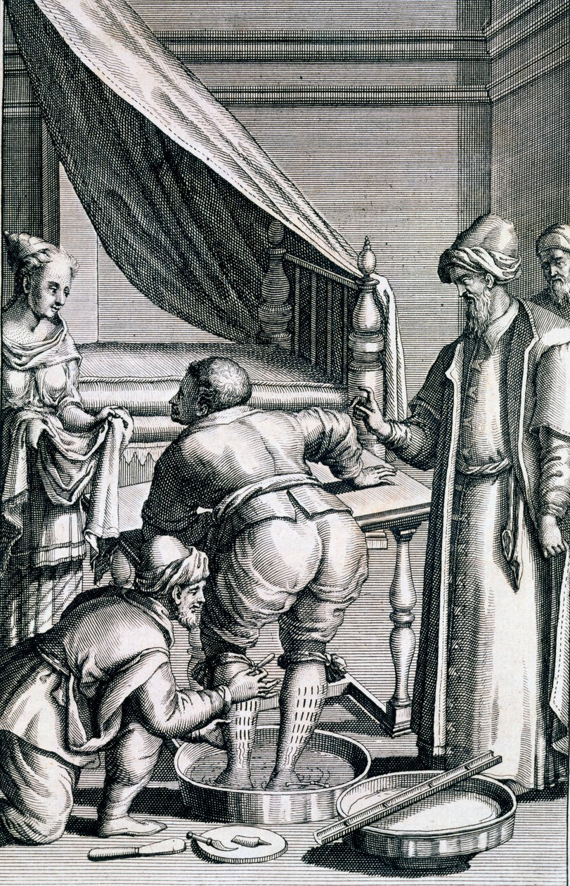 Bloedafname in de benen, uit Medicina Aegyptiorum door Prospero Alpini, gepubliceerd 1745 door Italian School