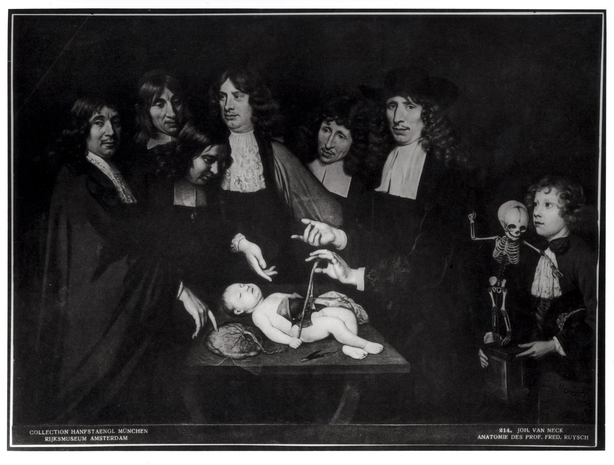 De Anatomische Les van Professor Frederik Ruysch (1638-1731) ca. 1683 door Jan van Neck
