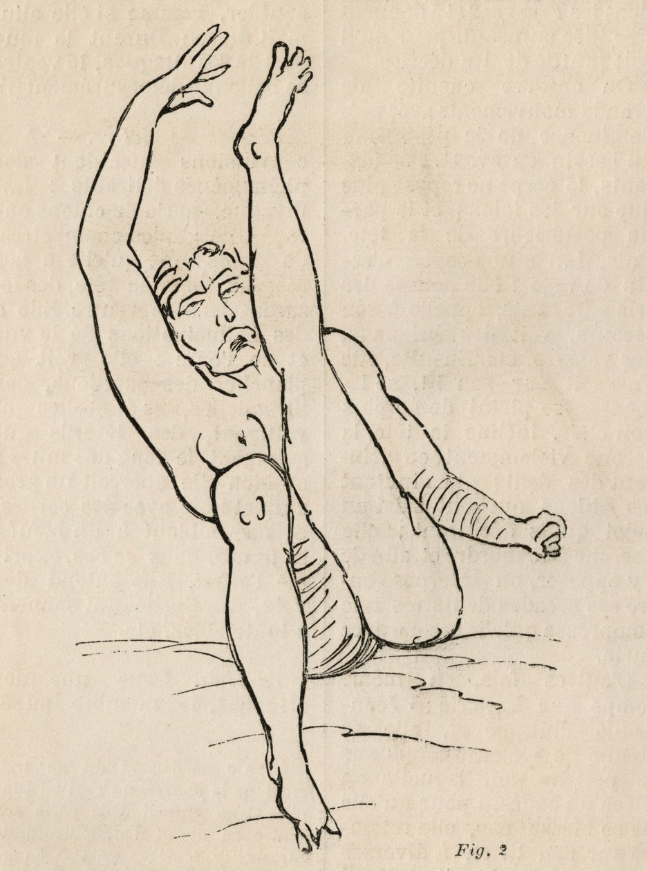 Hysterische epilepsie, aanval, vervormingen, fig. 2 uit 