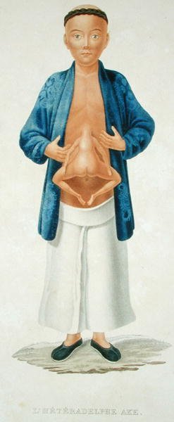 Chinese man met een onontwikkelde siamese tweeling aan zijn buik, illustratie uit een Frans reisboek, gegraveerd door M. Legrand door Jean Gabriel (after) Pretre