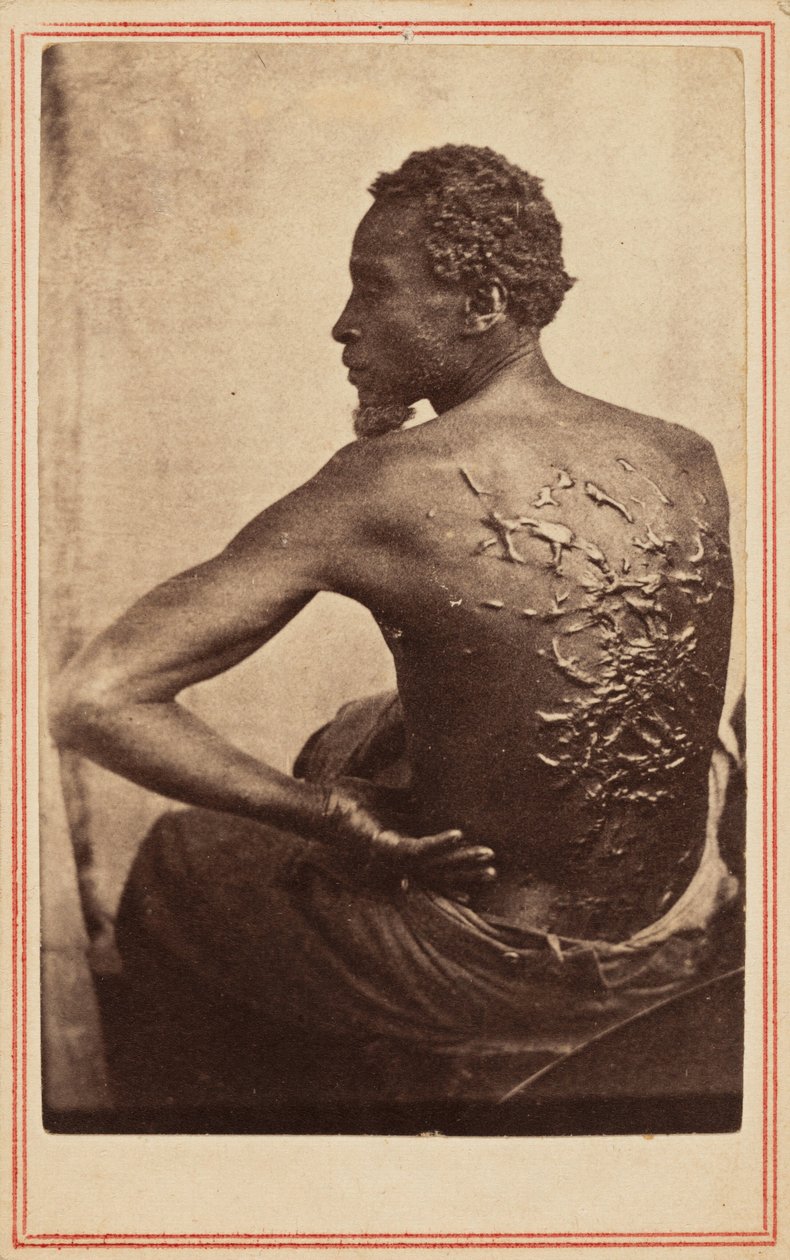 De gegeselde rug,c. 1863 (foto) door McPherson & Oliver