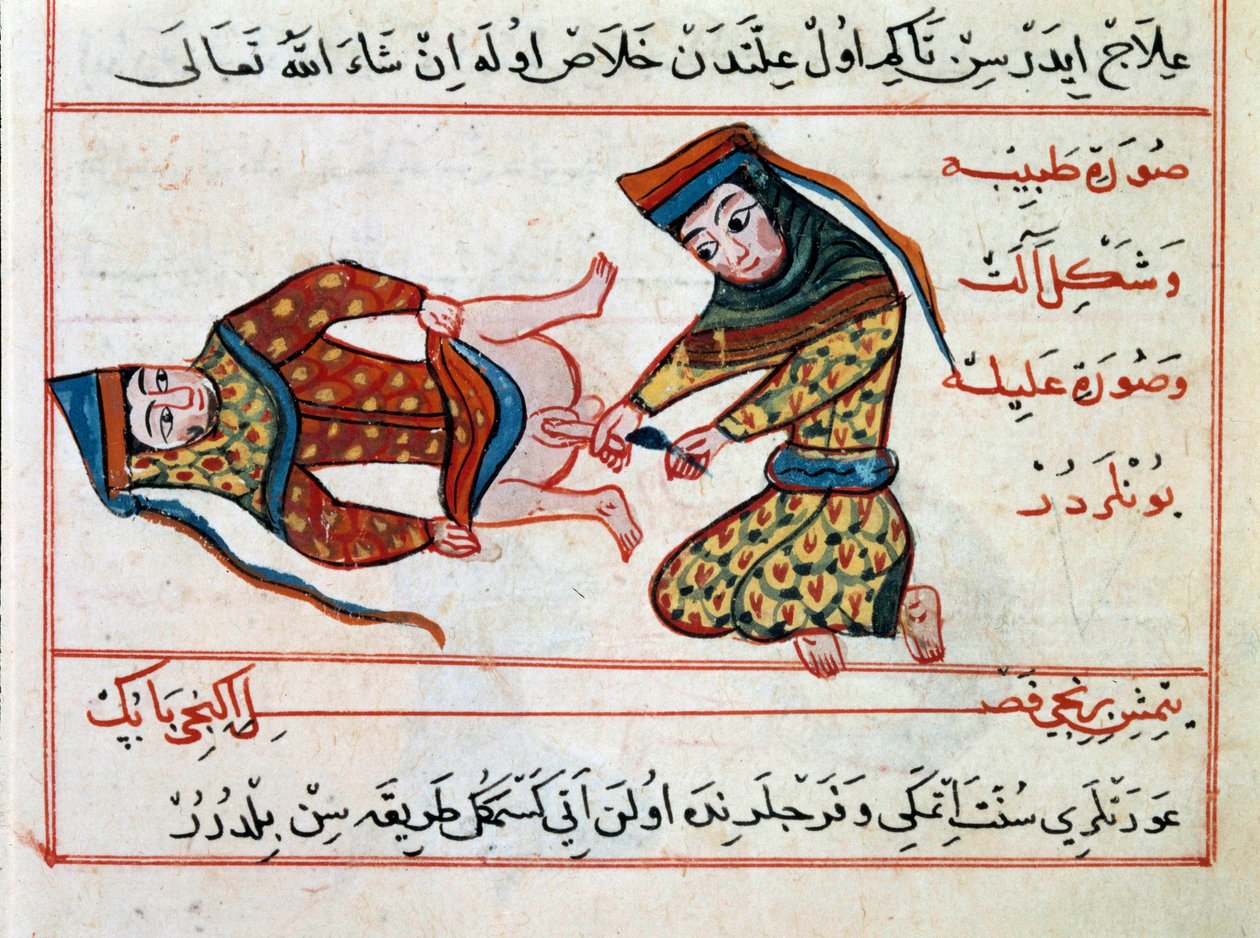 Medische operatie van een hermafrodiet door Ottoman School