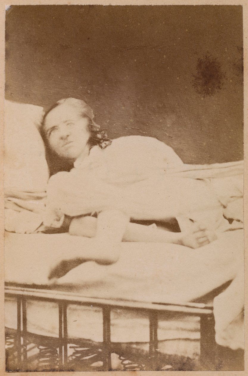 Hysterische epilepsie, vervormingen, plaat XXXVIII uit 