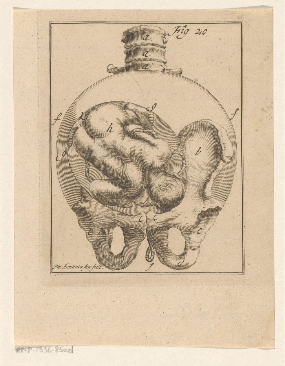 Foetus in baarmoeder door Philibert Bouttats (II)