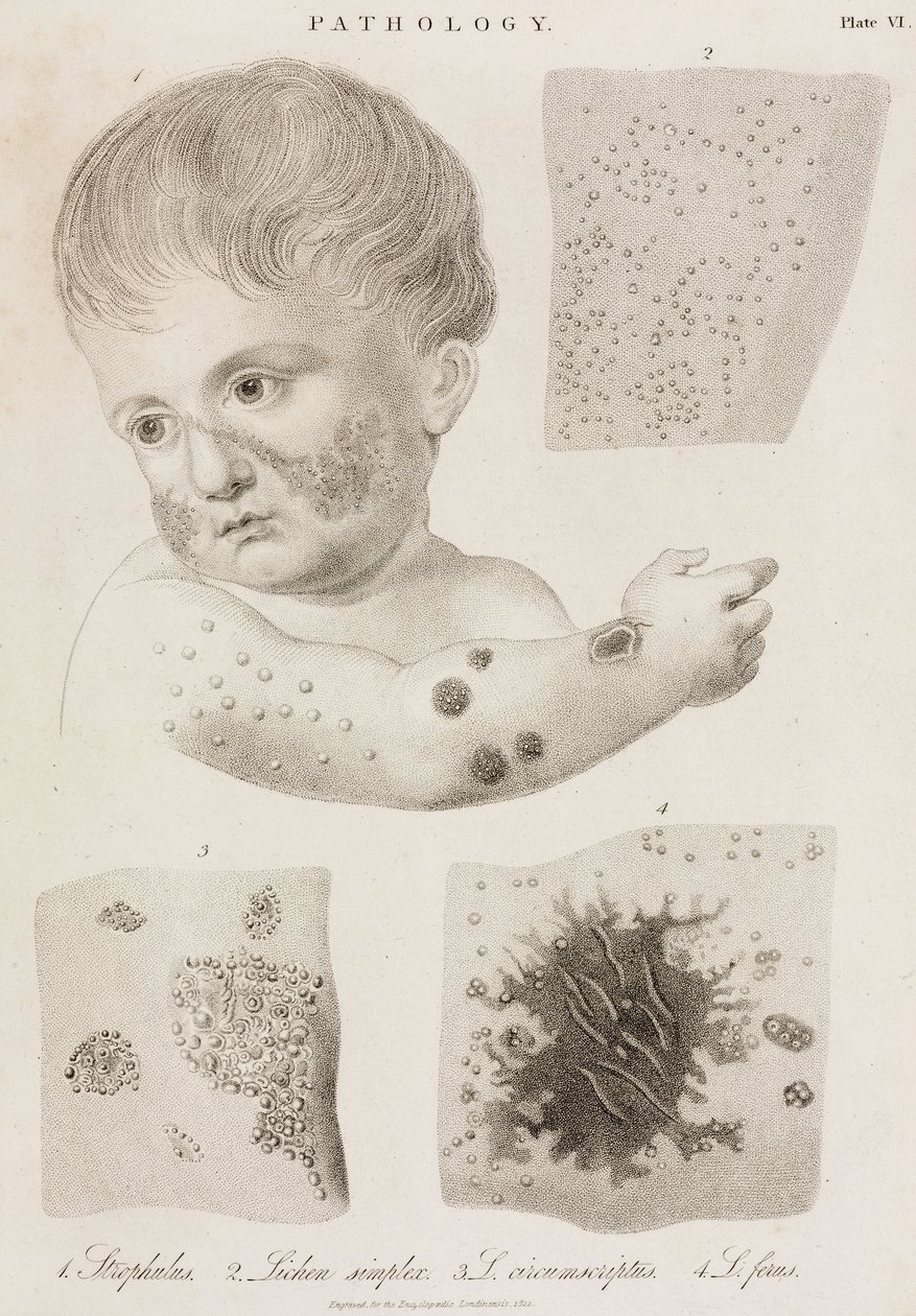Dermatologie Soorten huidziekten door John Pardon