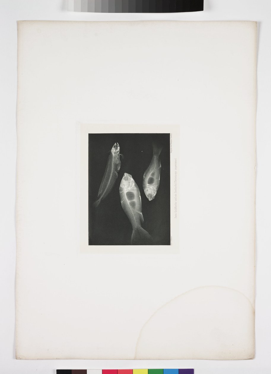 Diagnostische radiologie, röntgenfoto