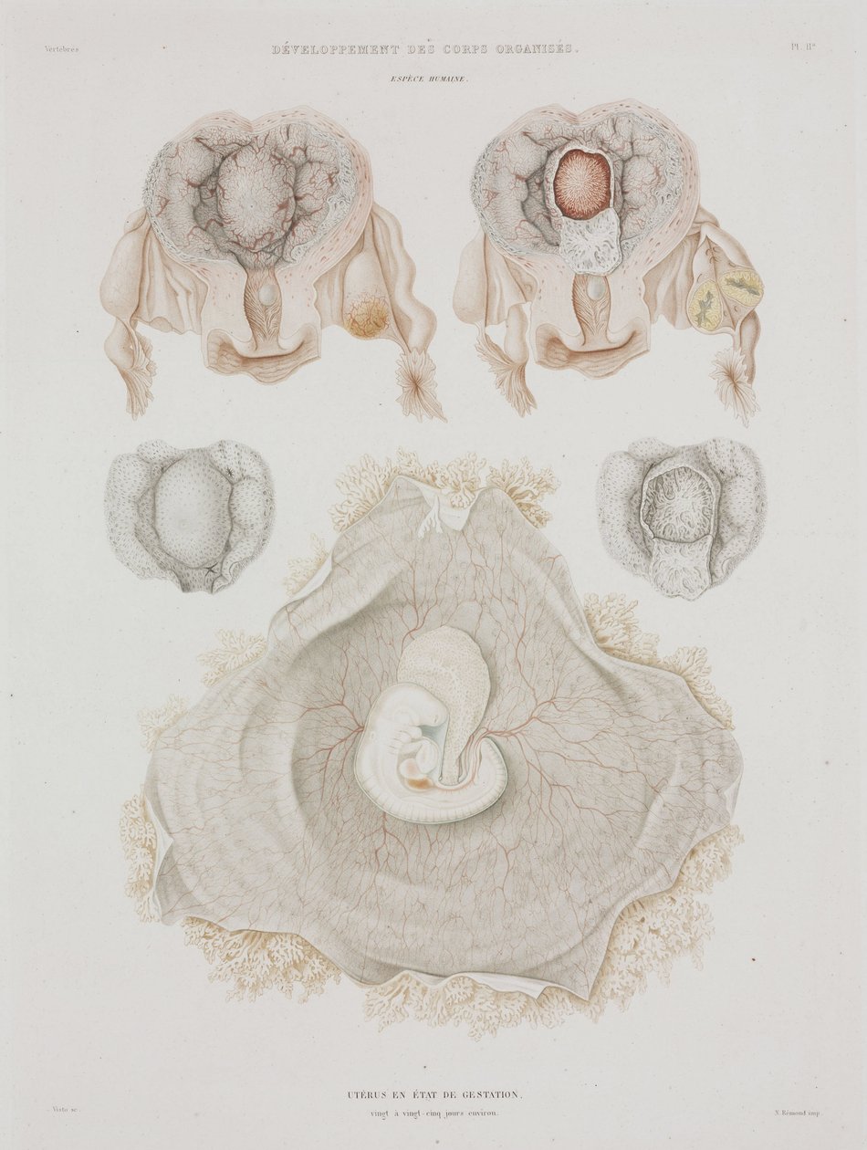 Gynaecologie Menselijke baarmoeder met embryo, ca. 1847-1859 door John Pardon
